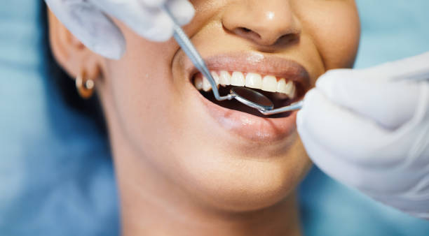 Best Emergency Treatment for Dental Infections or Abscesses in Cottonde, AL